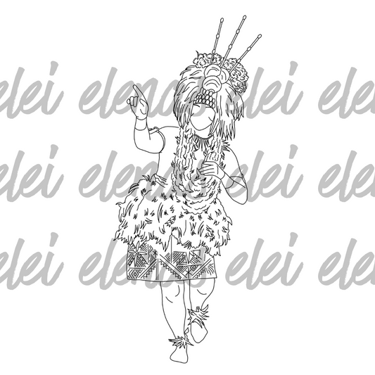 Talaleomalie